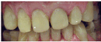 One sitting makeovers - help you  recover from years of neglect and returns some of your good looks